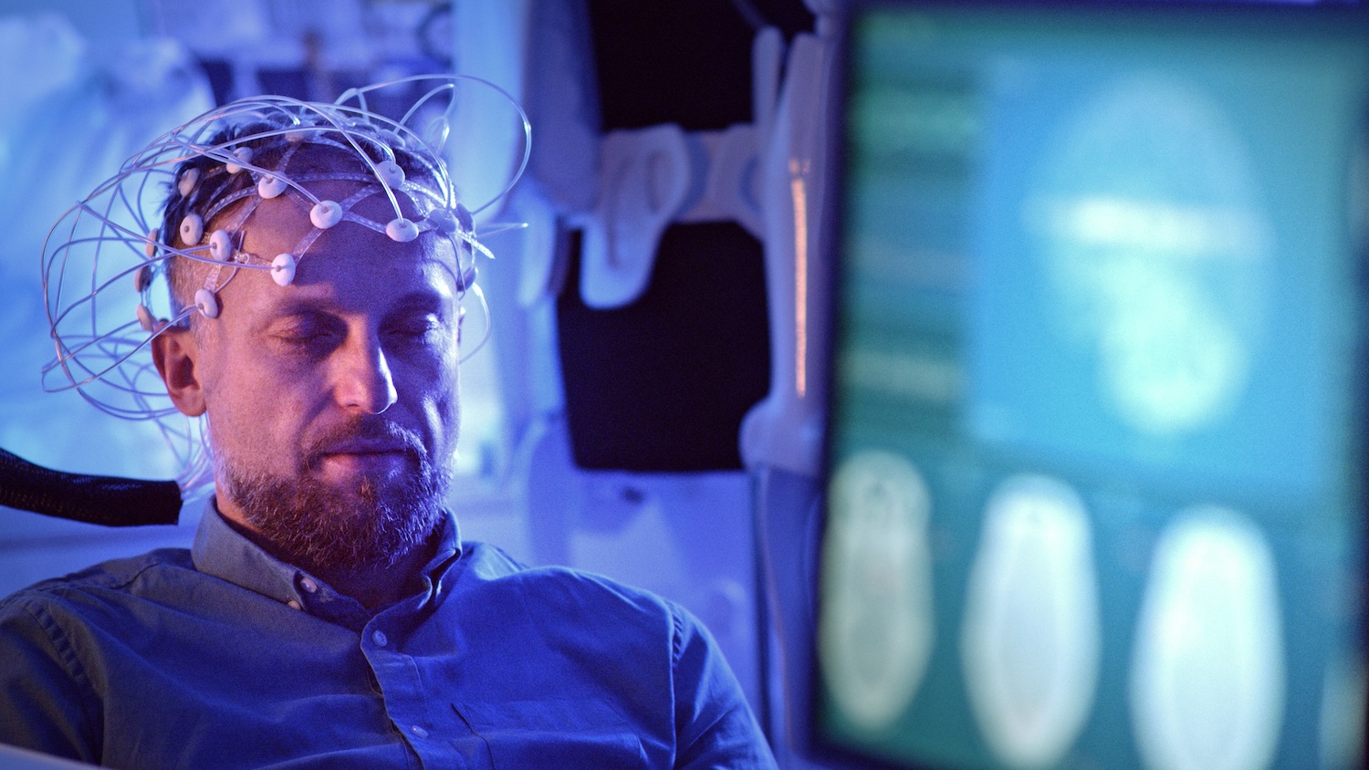neuroimaging Electroencephalography EEG